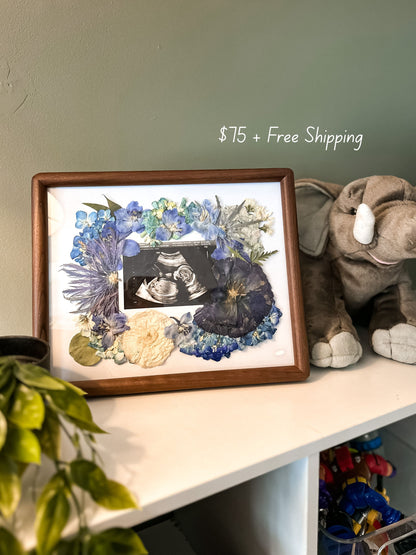 Ultrasound Flower Frame